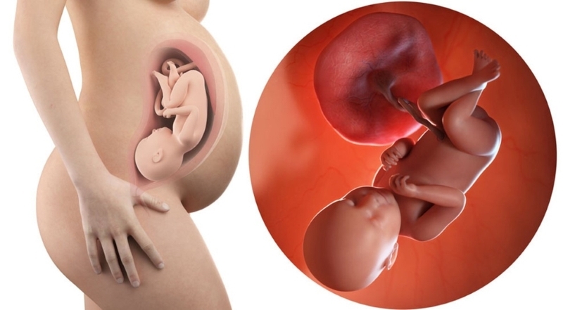 Kiểm tra vị trí em bé giúp xác định ngôi thai thuận lợi cho quá trình sinh thường an toàn Kiểm tra vị trí em bé giúp xác định ngôi thai thuận lợi cho quá trình sinh thường an toàn