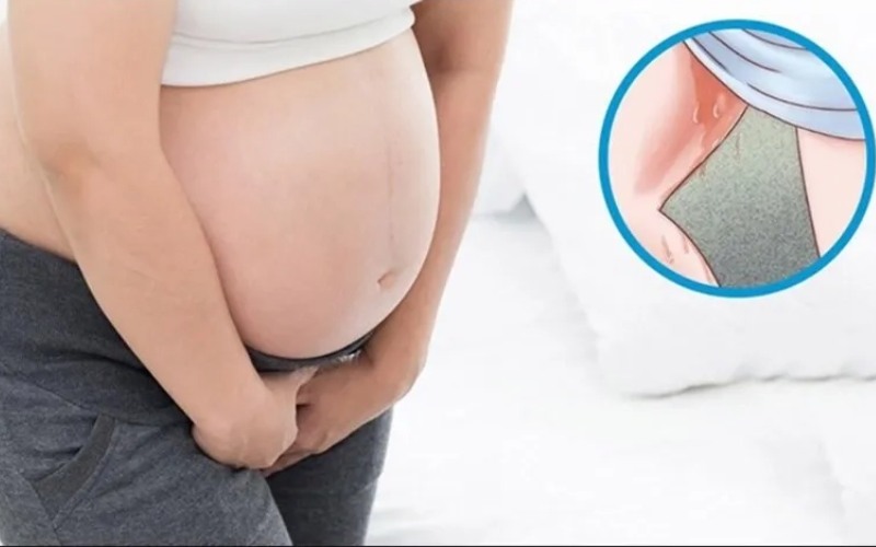 Tình trạng vỡ ối hoặc hở eo tử cung đe dọa sức khỏe mẹ và thai nhi