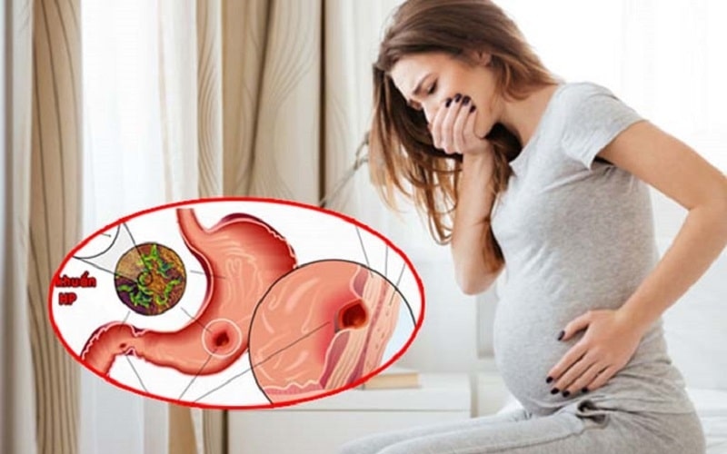 Tử cung triển gây áp lực lên dạ dày, tạo cảm giác nóng rát và khó chịu cho mẹ bầu