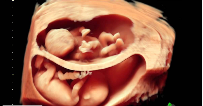 Siêu âm và Doppler màu giúp đánh giá chính xác sự phát triển và lưu lượng máu của thai nhi