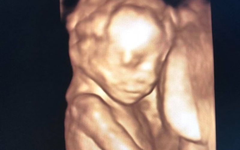 Trên màn hình siêu âm, mẹ bầu có thể quan sát rõ khuôn mặt của bé